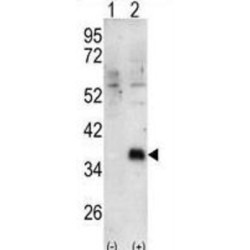 Docking Protein 4 (DOK4) Antibody