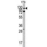 Tyrosine-Protein Kinase ABL1 (ABL1) Antibody