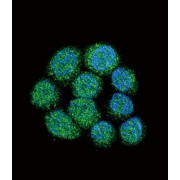 Tyrosine-Protein Kinase BTK (BTK) Antibody