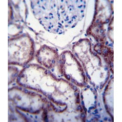 Tyrosine Protein Kinase Fer (FER) Antibody