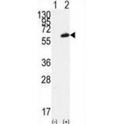 Tyrosine-Protein Kinase Fgr (FGR) Antibody