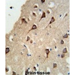 FYN Oncogene Related To SRC, FGR, YES (FYN) Antibody