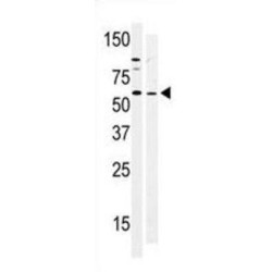 Protein Tyrosine Kinase 6 (PTK6) Antibody
