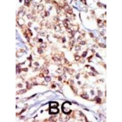 SRC Proto-Oncogene, Non-Receptor Tyrosine Kinase (SRC) Antibody