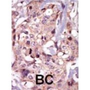 Tyrosine-Protein Kinase Tec (TEC) Antibody