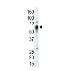 Tyrosine-Protein Kinase Tec (TEC) Antibody