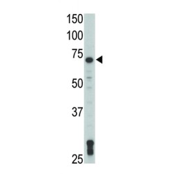 Tyrosine-Protein Kinase TXK (TXK) Antibody
