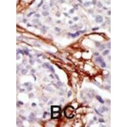 Tyrosine-Protein Kinase Yes (YES1) Antibody