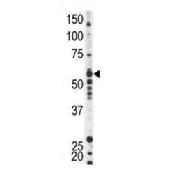 Tyrosine-Protein Kinase Yes (YES1) Antibody