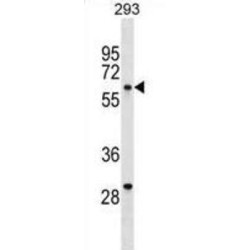 Tyrosine-Protein Kinase Yes (YES1) Antibody
