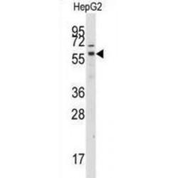 G Protein-Coupled Receptor Kinase 7 (GRK7) Antibody