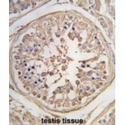 Pumilio Homolog 1 (PUM1) Antibody