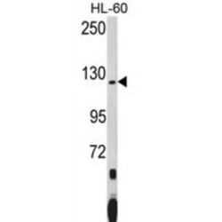 Pumilio Homolog 1 (PUM1) Antibody