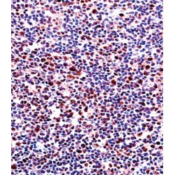 Runt-Related Transcription Factor 2 (RUNX2) Antibody