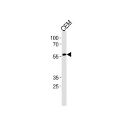 Runt-Related Transcription Factor 2 (RUNX2) Antibody