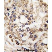 Pancreas/duodenum Homeobox Protein 1 (PDX1) Antibody