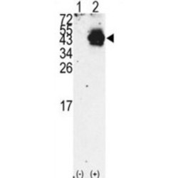 Pancreas/duodenum Homeobox Protein 1 (PDX1) Antibody