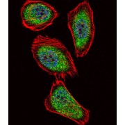 Insulin Promoter Factor 1 (IPF) Antibody