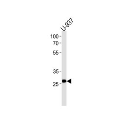 Insulin Promoter Factor 1 (IPF) Antibody
