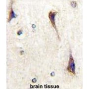 Cyclin Dependent Kinase 5 Activator 1 (CDK5R1) Antibody