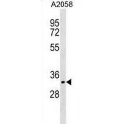 Cyclin Dependent Kinase 5 Activator 1 (CDK5R1) Antibody