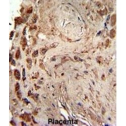 Interferon-Inducible Double-Stranded RNA-Dependent Protein Kinase Activator A (PRKRA) Antibody