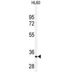 Interferon-Inducible Double-Stranded RNA-Dependent Protein Kinase Activator A (PRKRA) Antibody