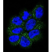 GTPase NRas (NRAS) Antibody