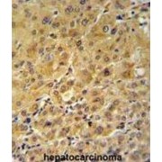 FK506 Binding Protein 1A (FKBP1A) Antibody