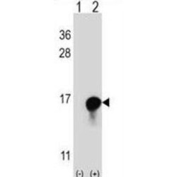 FK506 Binding Protein 1A (FKBP1A) Antibody