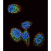 GTPase HRas (HRAS) Antibody