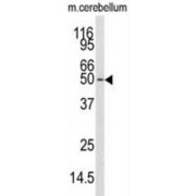Calcium/Calmodulin Dependent Protein Kinase Kinase 1 (CAMKK1) Antibody