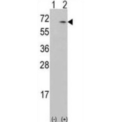 Calcium/Calmodulin Dependent Protein Kinase Kinase 1 (CAMKK1) Antibody