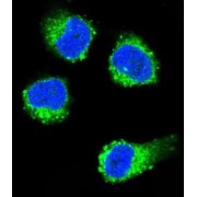 Nerve Growth Factor (NGF) Antibody