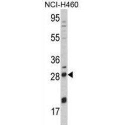 Nerve Growth Factor (NGF) Antibody