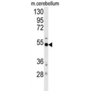 Beta-Secretase 1 (BACE1) Antibody