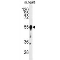 Beta-Secretase 1 (BACE1) Antibody