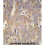 Latent Transforming Growth Factor Beta Binding Protein 1 (LTBP1) Antibody