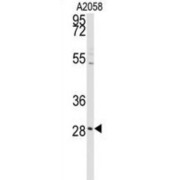 Protein Kinase C Delta-Binding Protein (PRKCDBP) Antibody