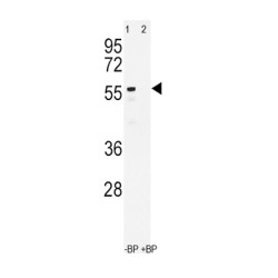 Cytochrome P450 3A4 (CYP3A4) Antibody