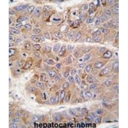 Insulin Receptor Substrate 2 (IRS2) Antibody