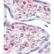 Immunohistochemical analysis of formalin-fixed and paraffin-embedded human Placenta tissue reacted with IRAK Antibody (C-term), which was peroxidase-conjugated to the secondary antibody, followed by AEC staining.