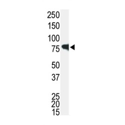 IRAK Antibody