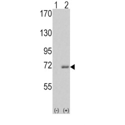 IRAK Antibody