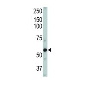 Serine/threonine-Protein Kinase Receptor R3 (ACVRL1) Antibody