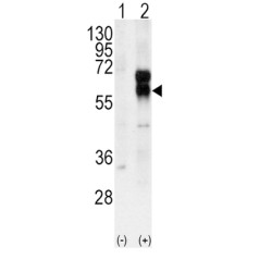 Serine/threonine-Protein Kinase Receptor R3 (ACVRL1) Antibody