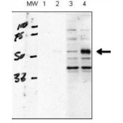 Serine/threonine-Protein Kinase Receptor R3 (ACVRL1) Antibody