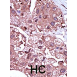 Serine/threonine-Protein Kinase Receptor R3 (ACVRL1) Antibody