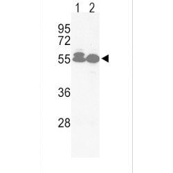 Serine/threonine-Protein Kinase Receptor R3 (ACVRL1) Antibody