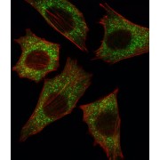 Serine/threonine-Protein Kinase B-Raf (B-RAF) Antibody